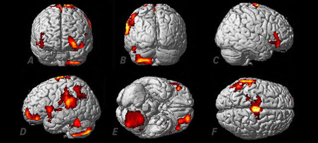 Scientists unlock mystery of out-of-body experiences